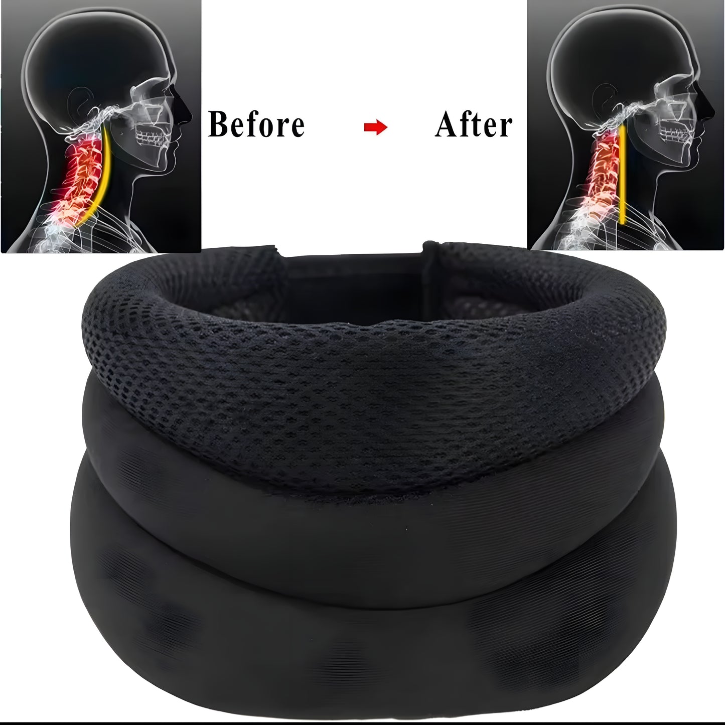 Vexzae™ Alivio Cervical Pro